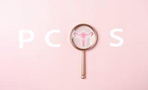 PCOS Laser hair removal