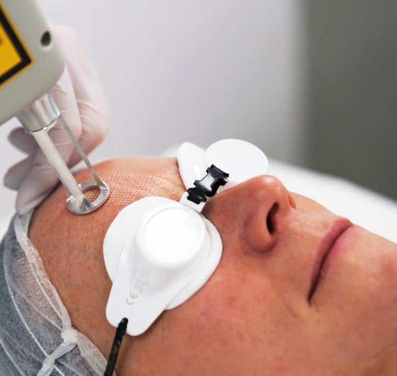 Lines and Wrinkles Treatment