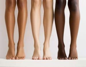 legs laser hair removal