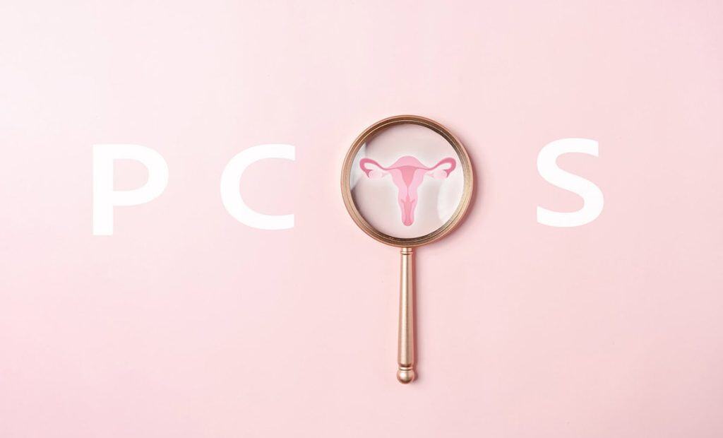 pcos laser hair removal