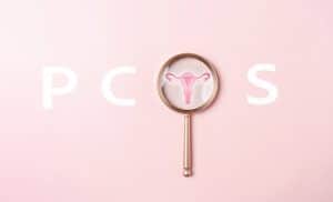 pcos laser hair removal