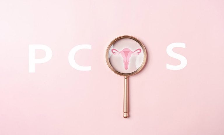 pcos laser hair removal