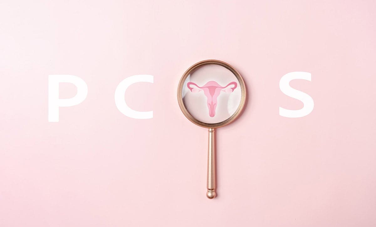 pcos laser hair removal